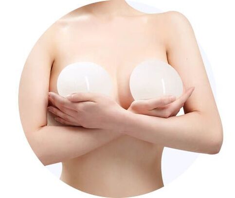 Αύξηση του μαστού με εμφυτεύματα