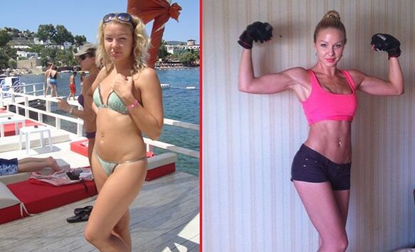 Φωτογραφίες πριν και μετά την αύξηση του μαστού με τη βοήθεια σπορ